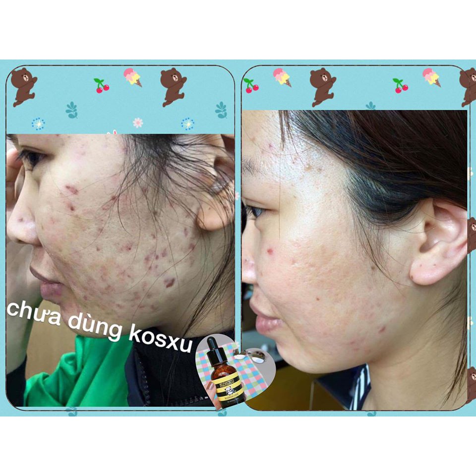 Serum Dưỡng Da khỏe, Căng Bóng, Phục Hồi Tái Tạo KOSXU HÀN QUỐC