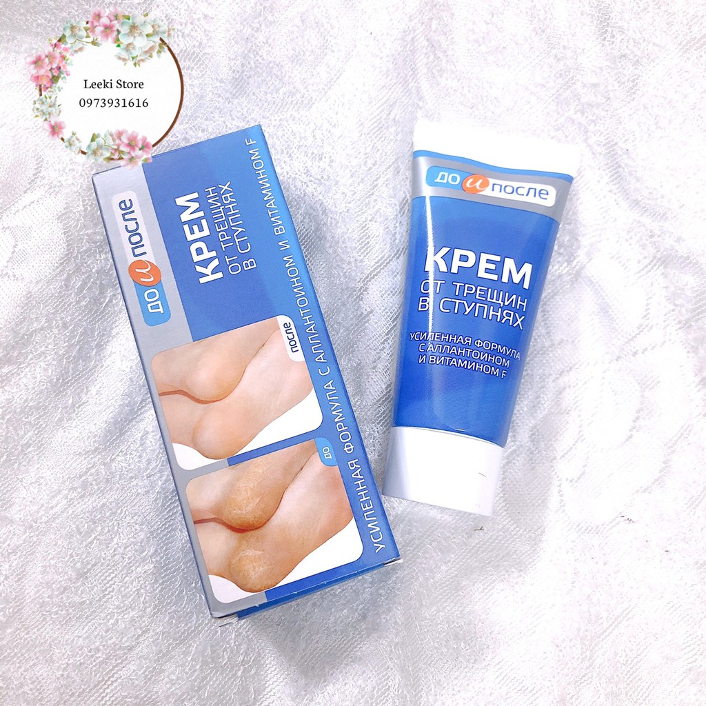 Kem Trị Nứt Gót Chân Kpem Apteka 50ml