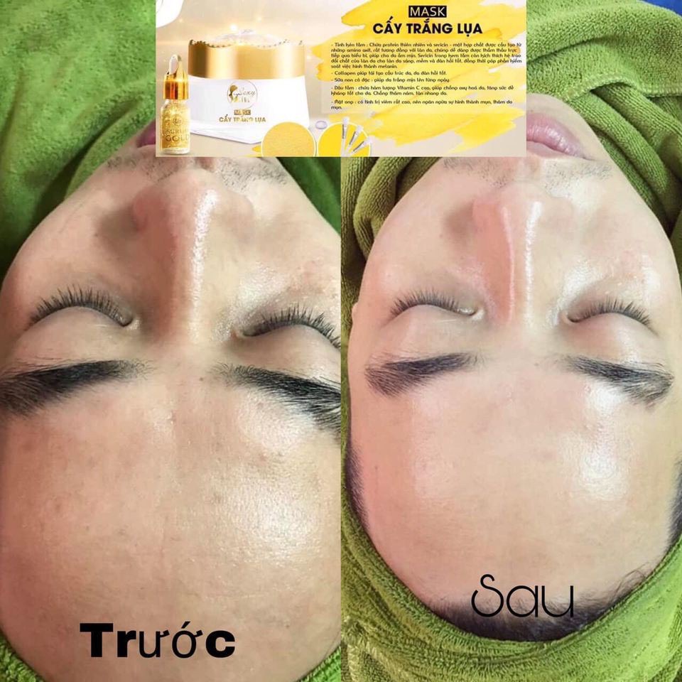 Cấy trắng lụa Hoàng Gia dùng cho cá nhân và spa