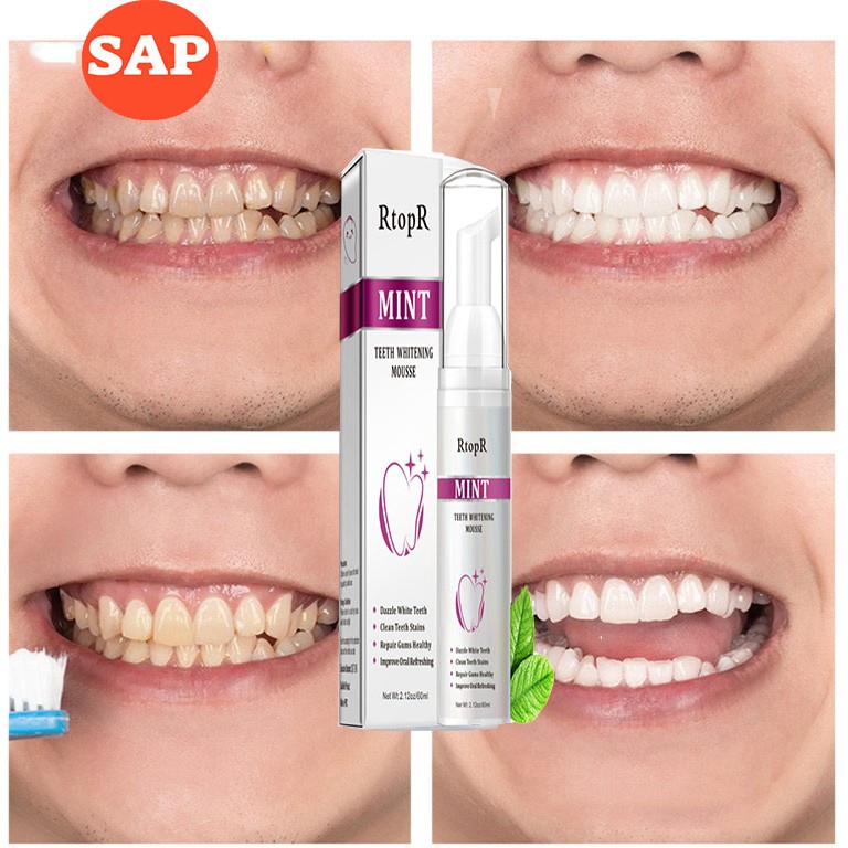 Bọt Tẩy Trắng Răng Làm Sạch Răng Khử Mùi Hôi Miệng Mousse Teeth Whitening Clean Teeth 60ml Thương Hiệu RtopR