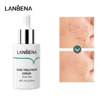 Serum giảm mụn Lanbena thu nhỏ lỗ chân lông phục hồi da 30ml