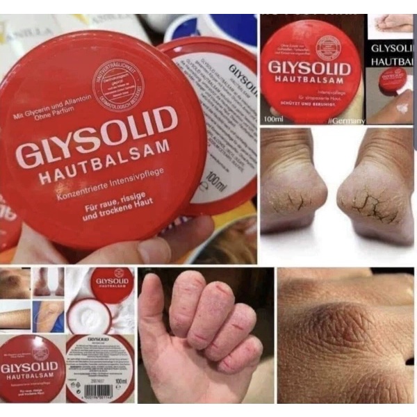 KEM NẺ Glysolid - Đức