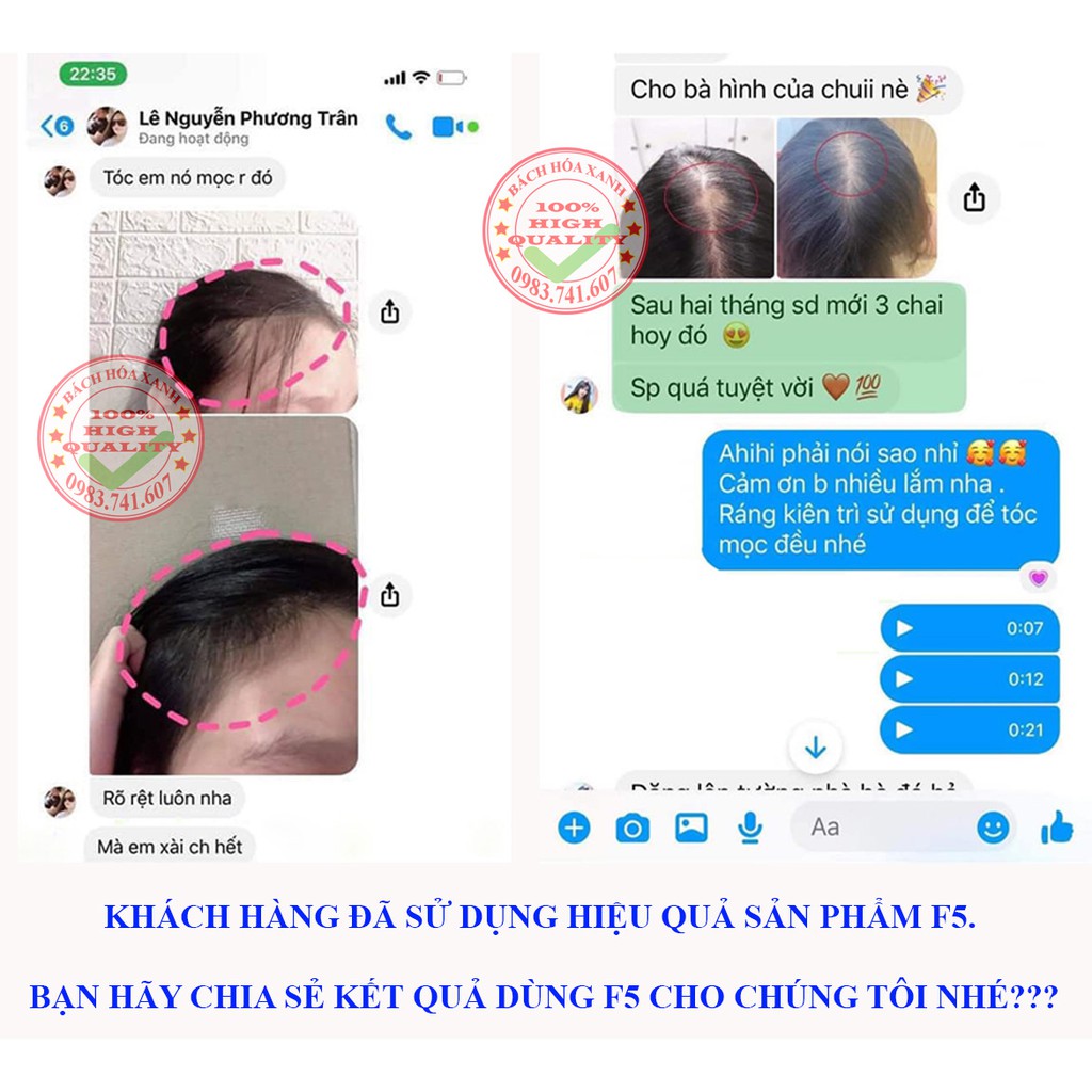 Dầu gội gội thảo dược ngăn rụng tóc F5, giảm rụng tóc, kích thích mọc tóc nhanh, an toàn, không gây kích ứng da đầu | BigBuy360 - bigbuy360.vn