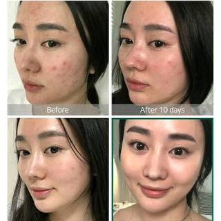 Nước hoa hồng thần kỳ