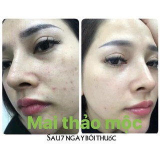Serum thảo mộc