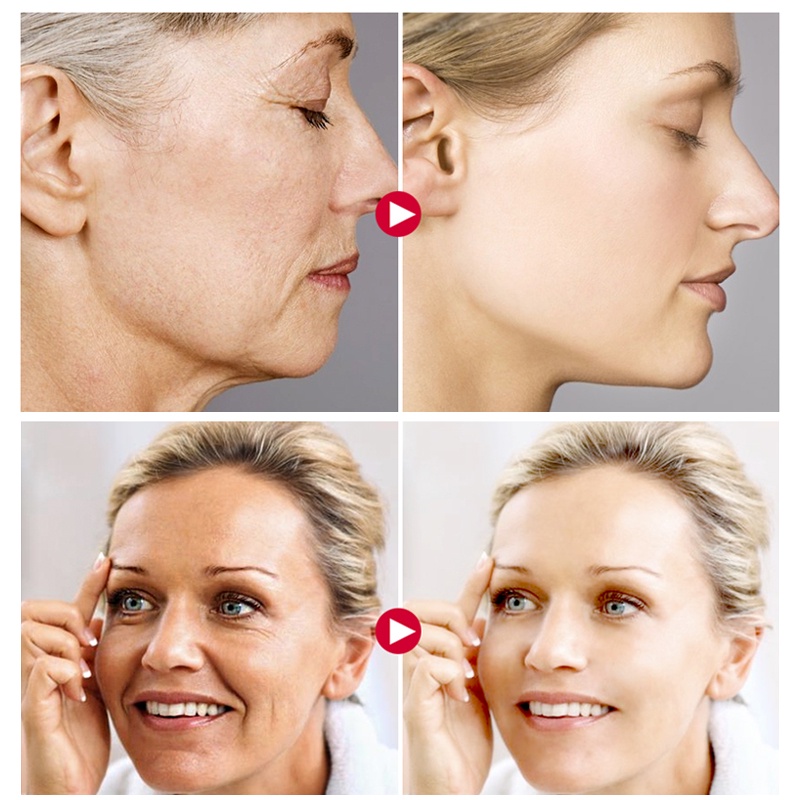 Kem Dưỡng Da Mặt LAIKOU Chiết Xuất Ốc Sên / Hyaluronic Acid / Collagen Dưỡng Ẩm Chống Lão Hóa Da