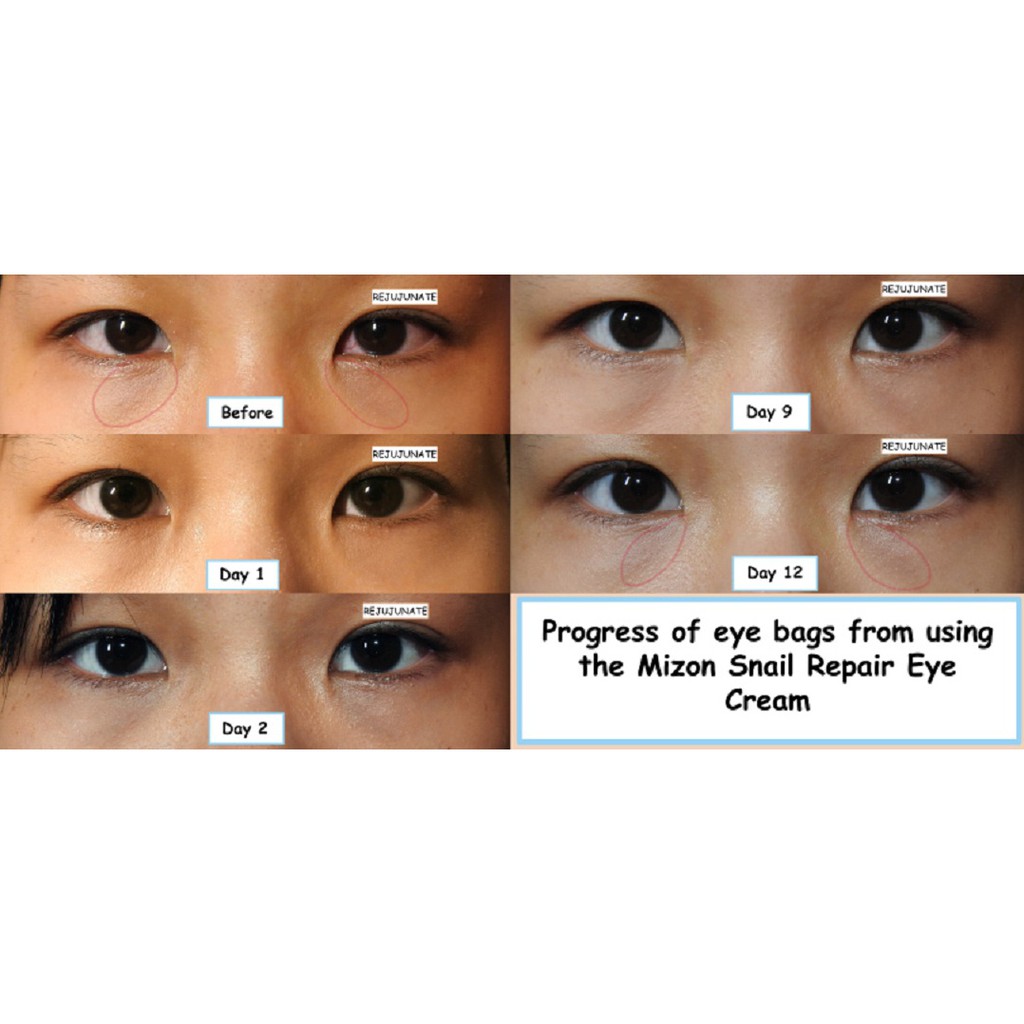 Kem dưỡng chống nhăn vùng mắt Mizon Snail Repair Eye Cream 25ml | BigBuy360 - bigbuy360.vn