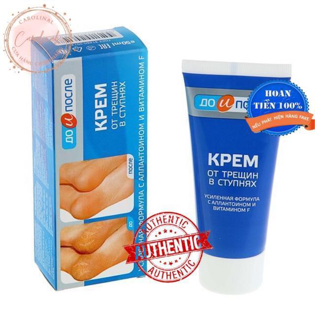 Kem dưỡng da tay chân [Hết nứt nẻ 100%-Hàng Auth] Kem chống nứt gót chân nga kpem foot cream 50ml