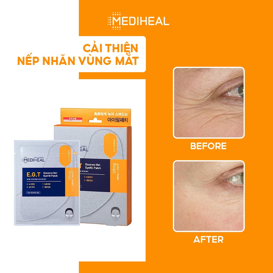 Mặt Nạ Làm Giảm Bọng Mắt Mặt Nạ Cải Thiện Nếp Nhăn Và Quầng Thâm Mắt Mediheal E.G.T Essence Gel Eyefill Patch 2.7g [K33]