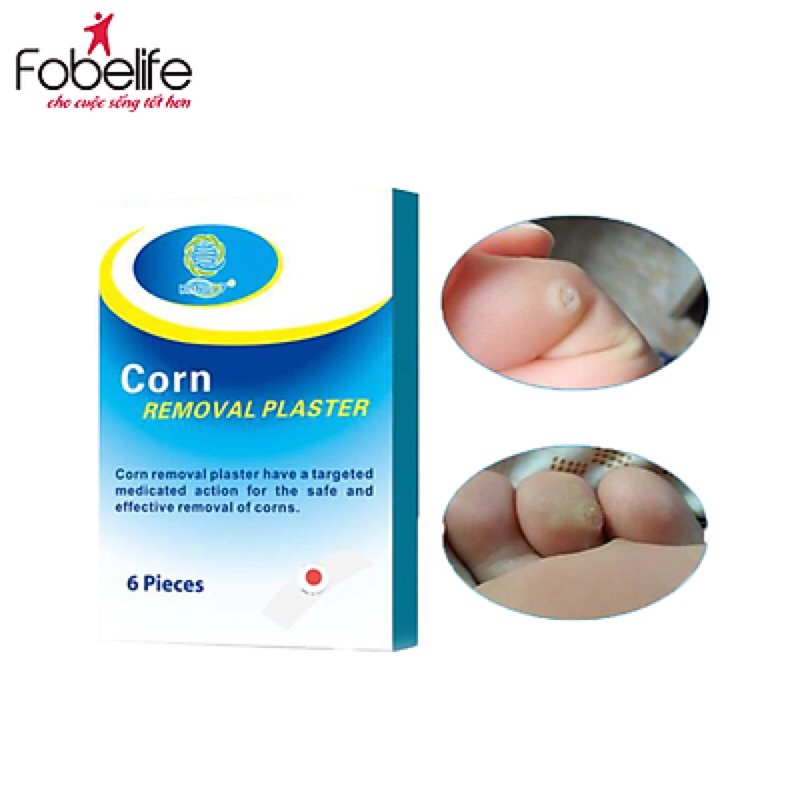 Miếng dán loại mụn cóc CornRemoval Plaster - Hộp 6 miếng (fobefile fobe file)