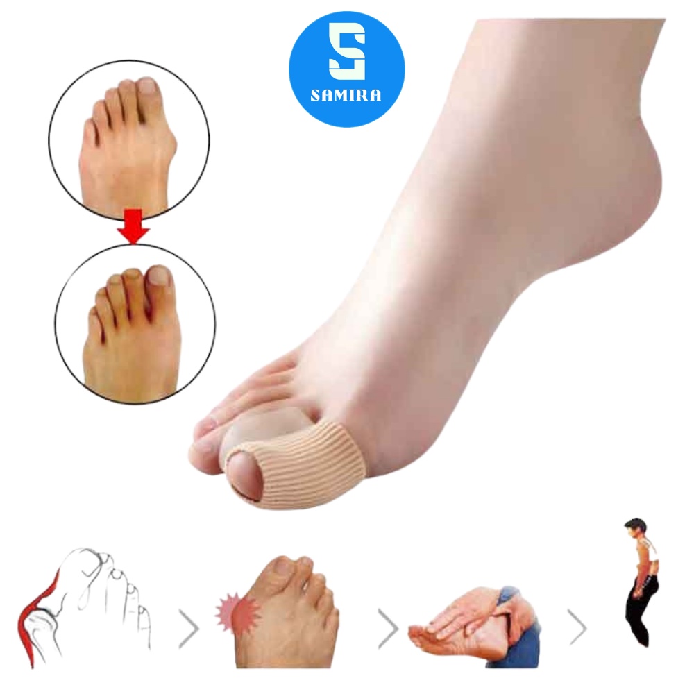 2 Dụng cụ silicon tách thẳng ngón chân cái ngón chân bị vẹo nhỏ gọn SA25