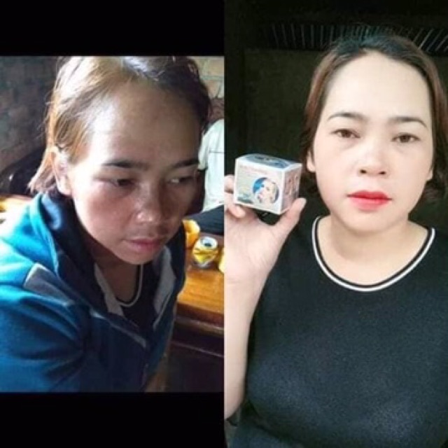 Kem dưỡng trắng da whitening  25g