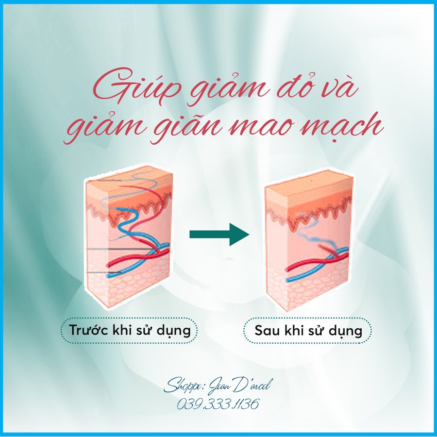 [CHÍNH HÃNG] Kem dưỡng giúp giảm giãn tĩnh mạch Jean D'arcel_ Jean Darcel Couperose Cream 30ML