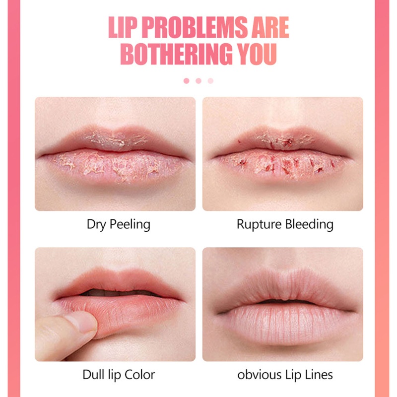 Set 10 Mặt Nạ Môi Tẩy Tế Bào Chết Tiện Dụng Chất Lượng Cao