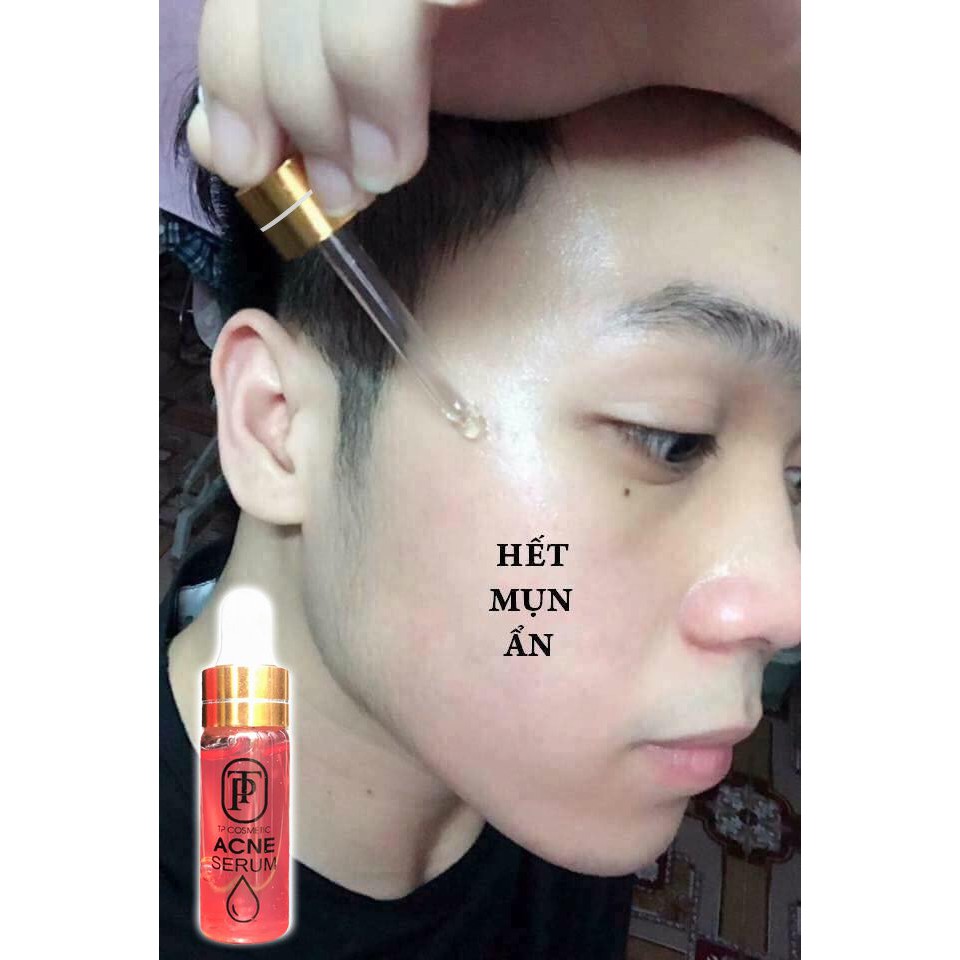[Chính hãng] Serum truyền trắng, tri mun TP Cosmetics - Dưỡng da trắng khỏe, mun không tái phát, phù hợp với da nhạy cảm | BigBuy360 - bigbuy360.vn