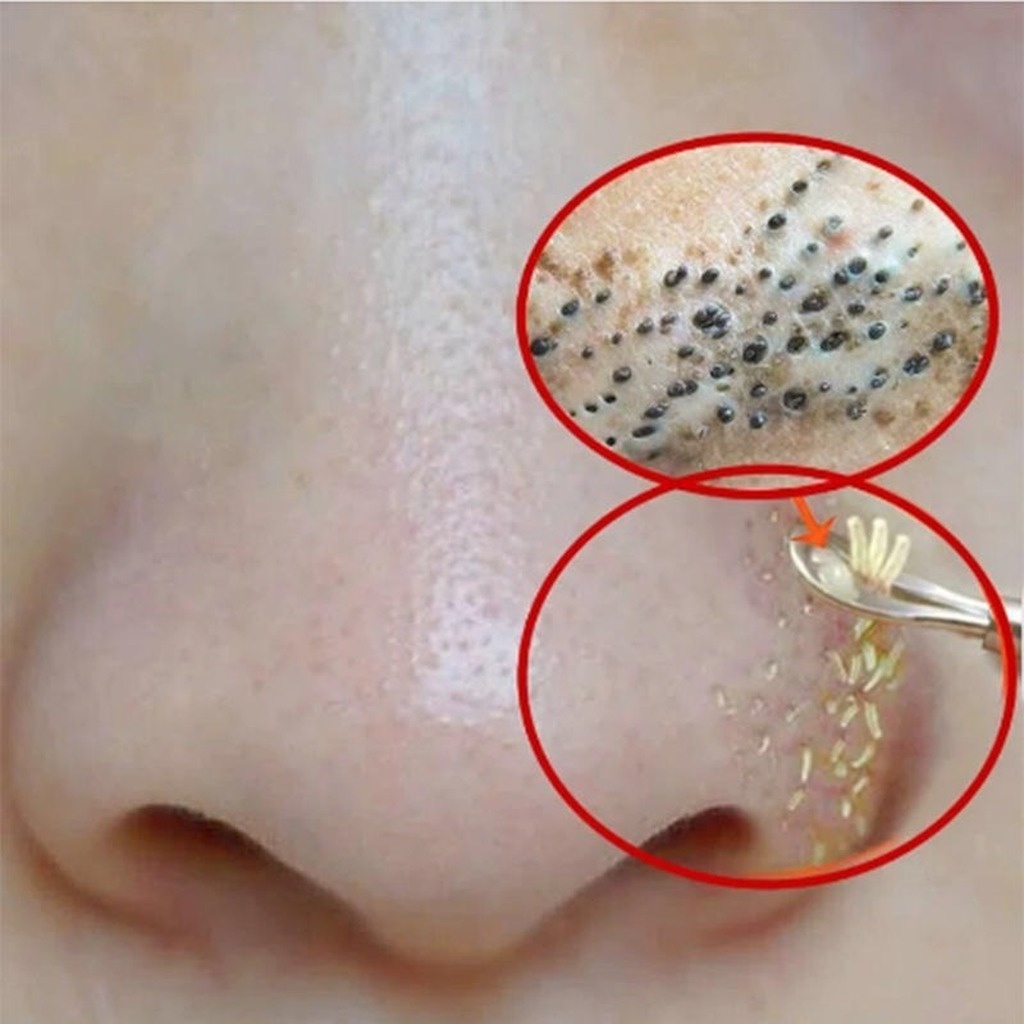 Mineral Mud Mask Peel Off Blackheads Shrink Pores