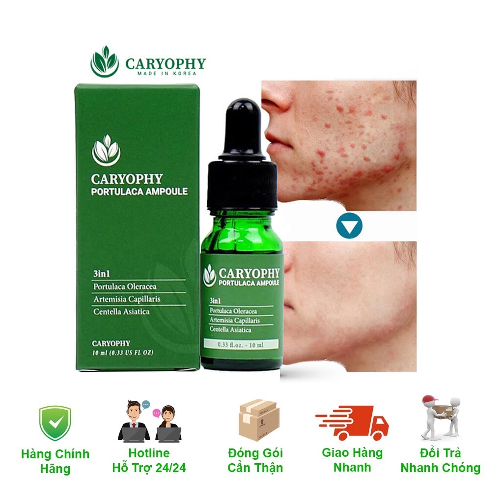 Serum Caryophy giảm mụn mờ thâm cho da dầu 10ml
