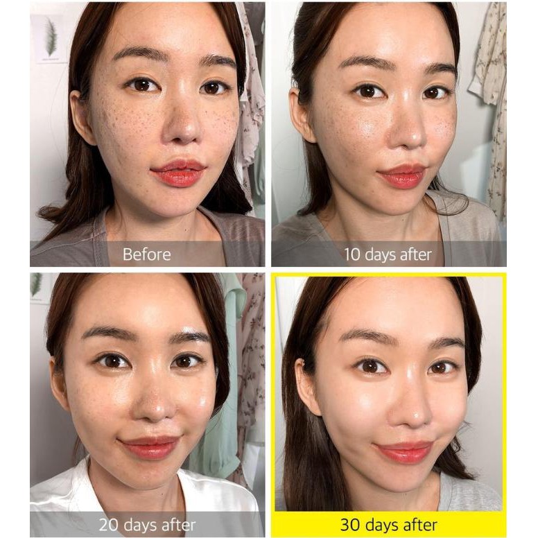 Some By Mi / Tinh Chất Dưỡng Trắng Da Some By Me Yuja Niacin 30 Days Blemish Care Serum