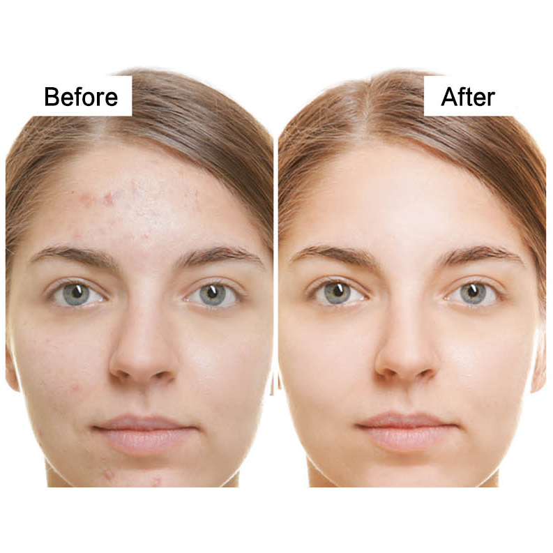 [Hàng mới về] Serum chiết xuất tràm trà/lô hội tự nhiên DR.RASHEL Hỗ Trợ Giảm mụn ngăn ngừa sẹo thêm | BigBuy360 - bigbuy360.vn