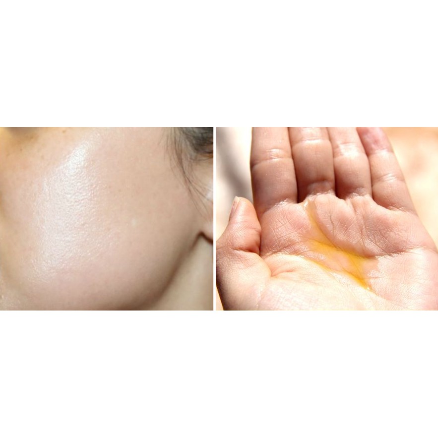 Sesderma C VIT Liposomal Serum  - Serum chống oxy hóa cao, làm sáng & phục hồi vẻ tự nhiên của da