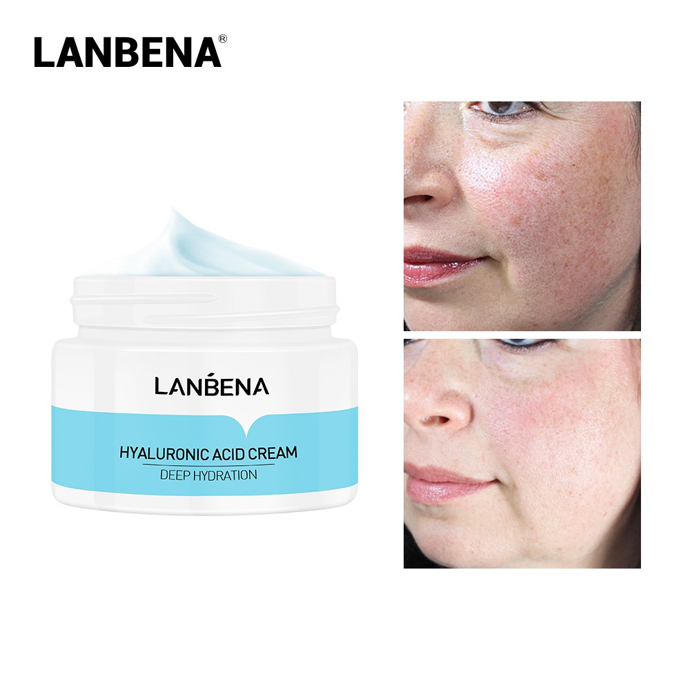 LANBENA Hyaluronic Acid Facial Cream Moisturizing Whitening Nourishing Anti-Aging Winkles Skin Care 50ml