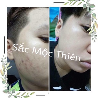 Linh Chi Mộc. Bột Linh Chi. Sắc Mộc Thiên. Bột Rửa Mặt