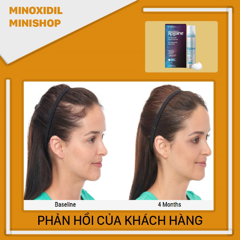 Dung Dịch Mọc Tóc, Mọc Lông Vùng Kín Minoxidil 5% Rogaine Dạng Bọt dành cho nữ