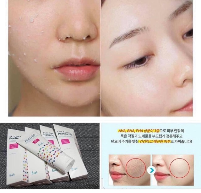 Tẩy da chết dịu nhẹ Prreti | BigBuy360 - bigbuy360.vn