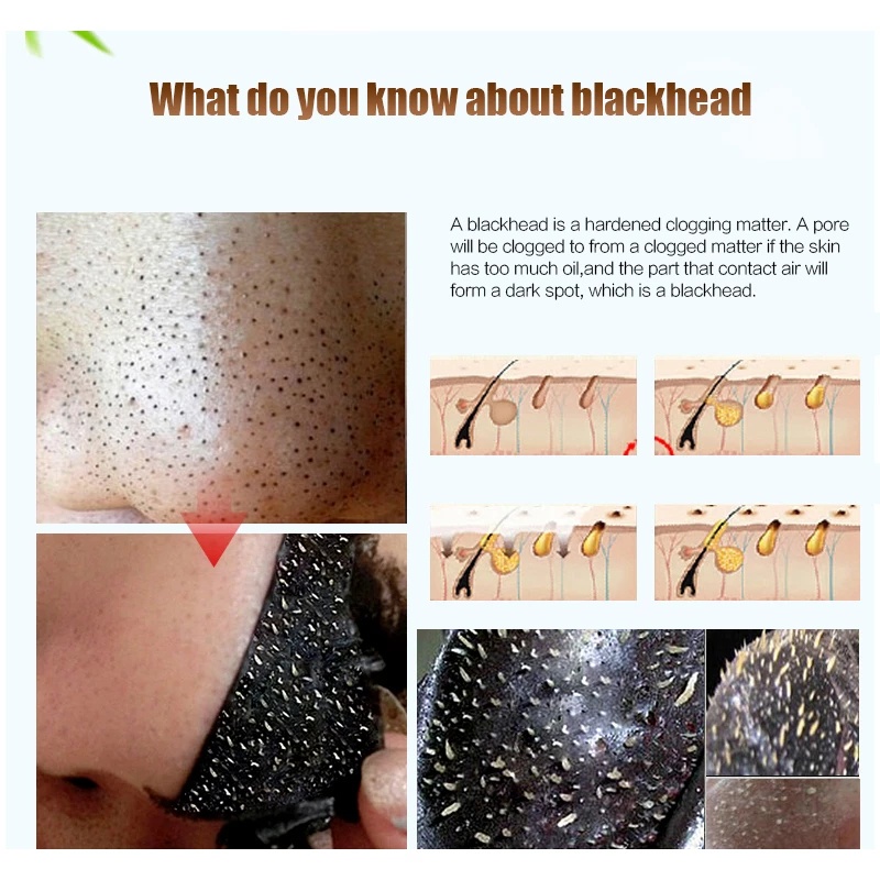 Mặt Nạ Bùn Khoáng Tẩy Tế Bào Chết Loại Bỏ Mụn Đầu Đen Nhẹ Nhàng Không Gây Kích Ứng Se Khít Lỗ Chân Lông Cho Mọi