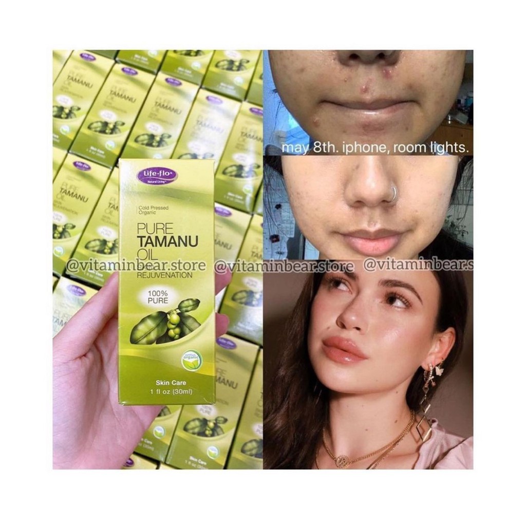 Dầu Tamanu Giúp Dưỡng Da, Mềm Mịn - 100% Thành Phần Từ Thiên Nhiên