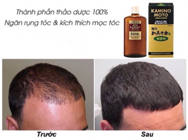 Tinh chất kích thích mọc tóc Kaminomoto