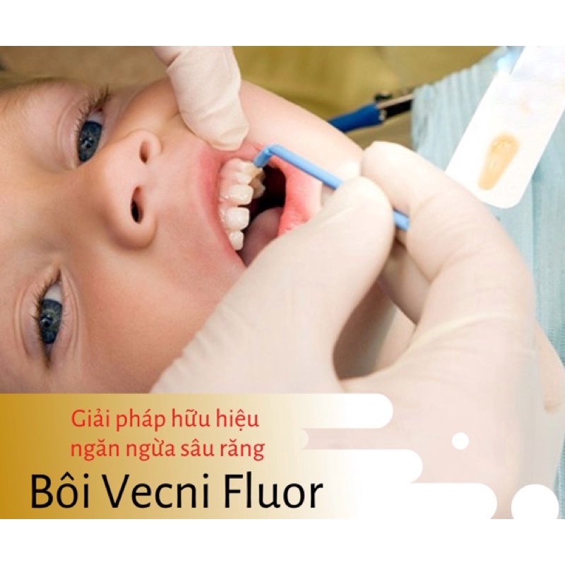 VECNI FLOUR kem bôi răng ngừa sâu răng, chống sún răng cho bé và người lớn V-VARNISH (SL:01 tuýt)