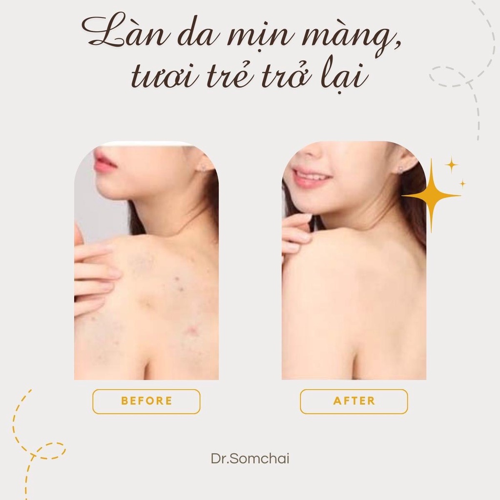 Xà phòng tắm DR. SOMCHAI ACNE SKIN CARE SOAP FOR NORMAL & SENSITIVE SKIN loại bỏ bụi bẩn, bảo vệ làn da nhạy cảm