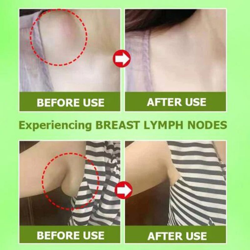 Miếng Dán Thải Độc Vùng Cổ Chống Sưng