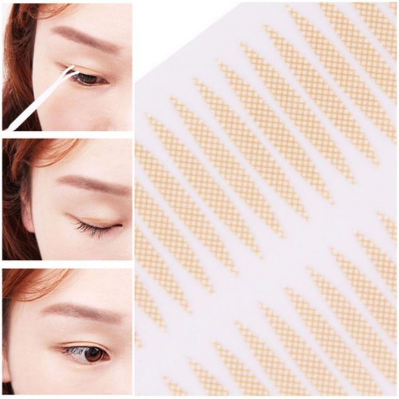 Combo 80 - 240 Vỉ Kích Mí Lưới Ren Kích Mí Không Kèm Que Nhấn