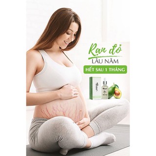 [Auth] Trị rạn da bae 50ml