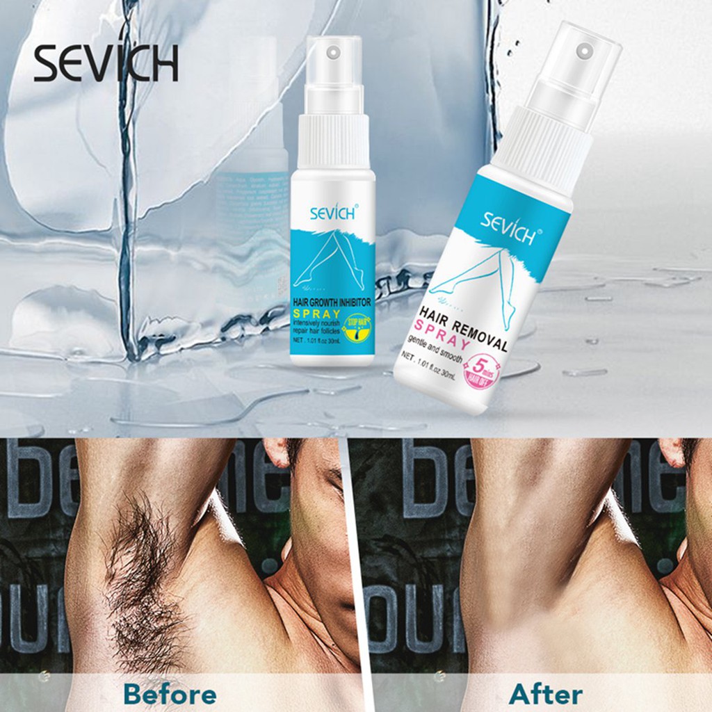 Combo Xịt Tẩy Lông 30ml + Xịt Ức Chế Quá Trình Phát Triển Lông 30ml Sevich