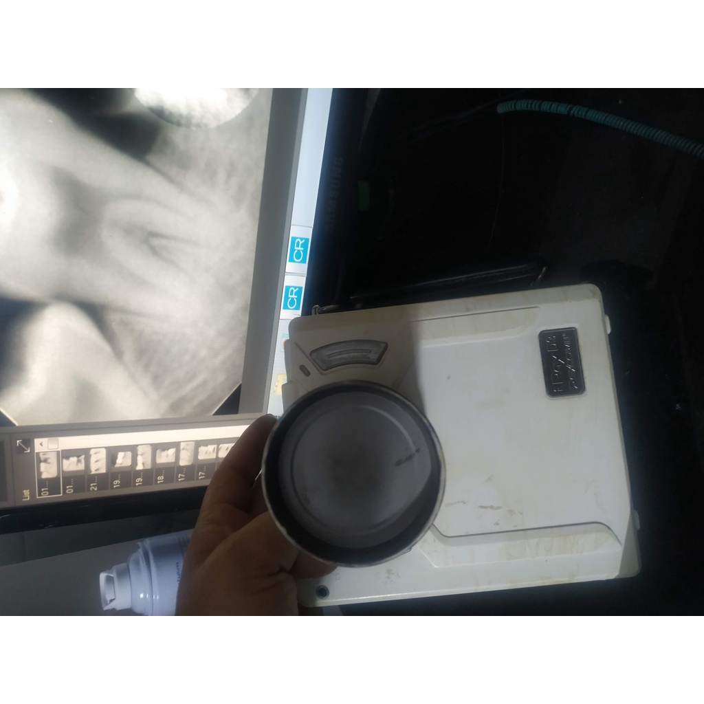 Pin máy chụp xquang DX-3000