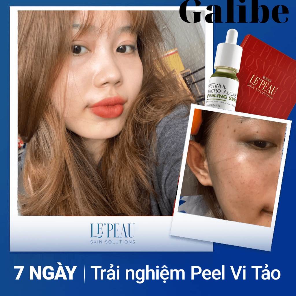 Peel da vi tảo LE PEAU peel da retinol, thay da sinh học giảm thâm, giảm sạm nám GALIBE OFFICIAL STORE