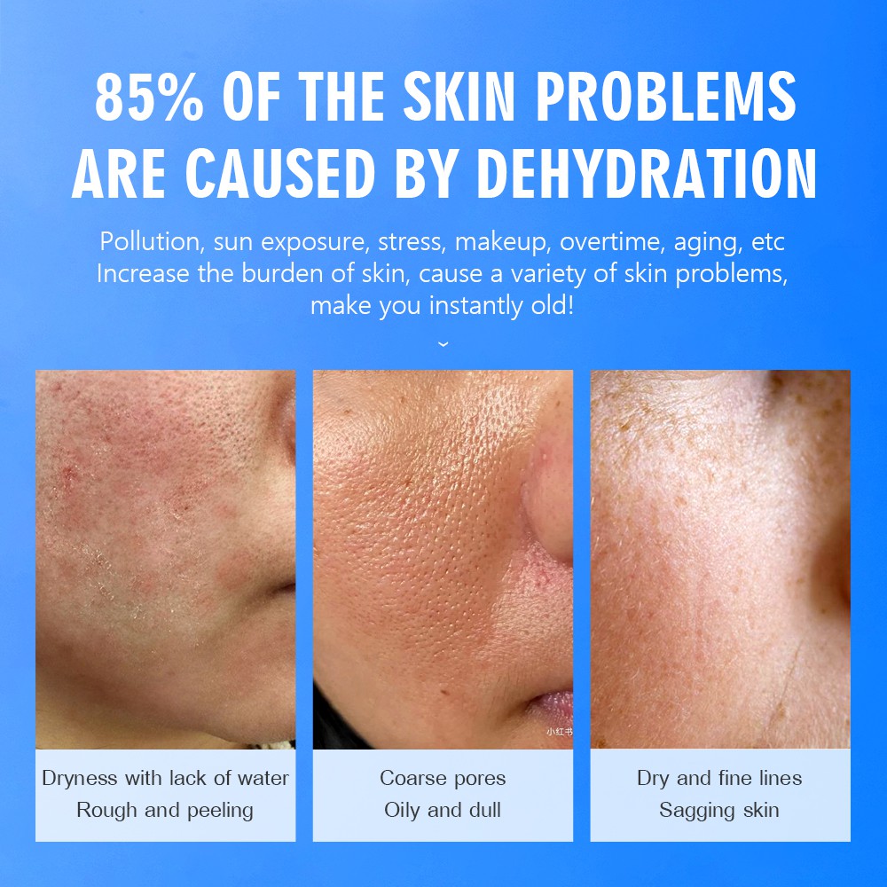 Serum VIBRANT GLAMOUR Chiết Xuất Axit Hyaluronic Giữ Ẩm Giảm Mụn Và Nếp Nhăn Làm Trắng Thu Nhỏ Lỗ Chân Lông 30ml | BigBuy360 - bigbuy360.vn