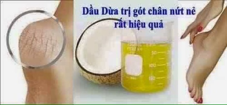 DẦU DỪA NGUYÊN CHẤT CẦU BÌNH AN