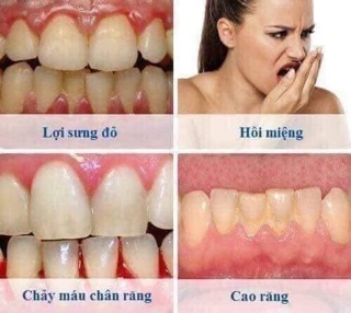 BỘT TRẮNG RĂNG TWHITE