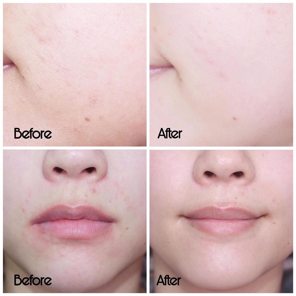 Kem dưỡng da SVR làm giảm mụn và giúp loại bỏ dầu cho da Sebiaclear Active 40ml SVR005