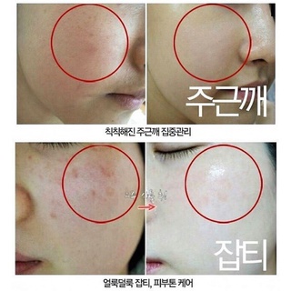 Kem Ngừa Nám Và Tàn Nhang Melasma-X 3D Whitening Clinic Cream