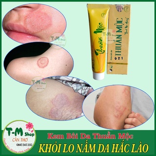 KEM BÔI DA LIỄU