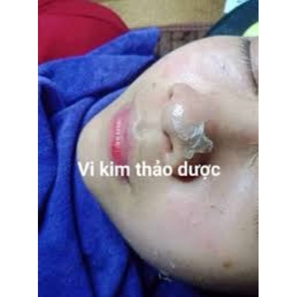 Vi Kim Thảo Mộc Siêu Vi Kim Thảo Dược Loại 1 Bong Mạnh