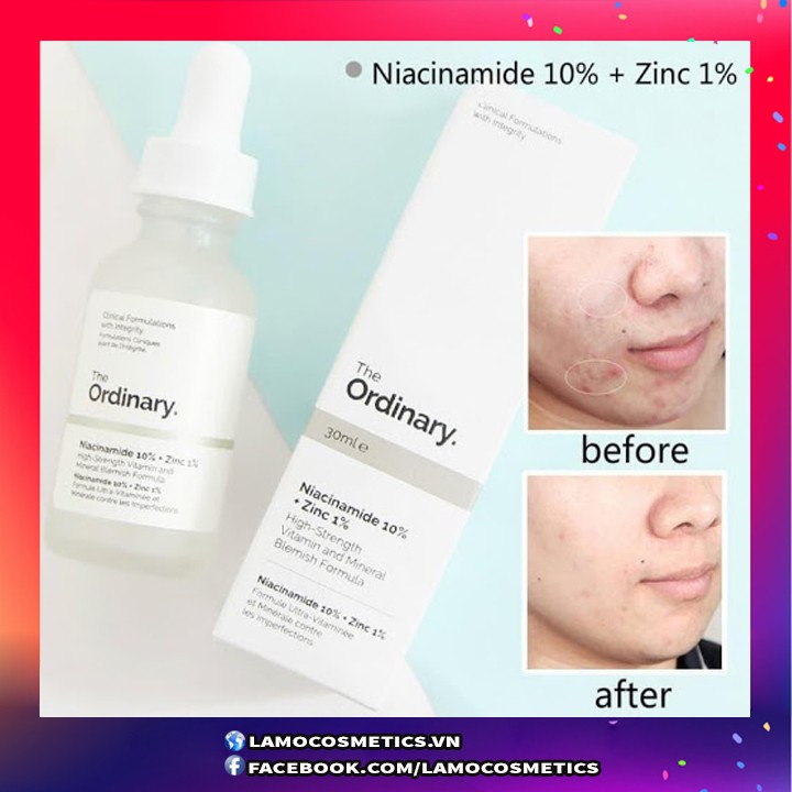 Tinh Chất The Ordinary Niacinamide 10% + Zinc 1% Chính Hãng 100%