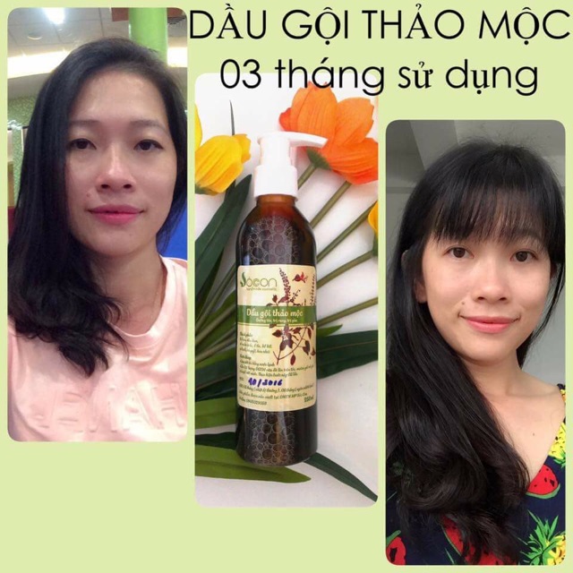 <Sài cho cả bé>  Combo Dầu Gội Thảo Mộc trị rụng tóc & Sữa Tắm Thảo Mộc 100% hiệu Sóc Con - TỐT SAU SINH