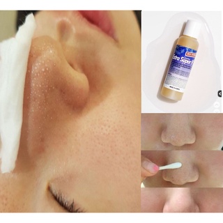 Dung dịch ủ mụn Medipeel - 50ml