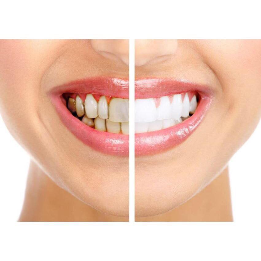 NƯỚC SÚC MIỆNG CREST 3D WHITE GLAMOROUS WHITE ALCOHOL FREE 946ML CHÍNH HÃNG - 3760